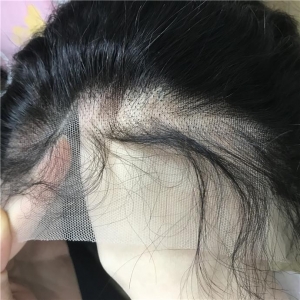 پروتز مو و روش های اتصال روی سر